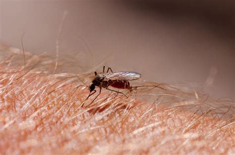 Mosquito Bite Treatment: Do These 18 Homemade Remedies Work? | HuffPost Canada Life