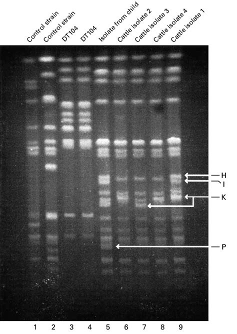 Results Of Pulsed Field Gel Electrophoresis Of Isolates Of Salmonella