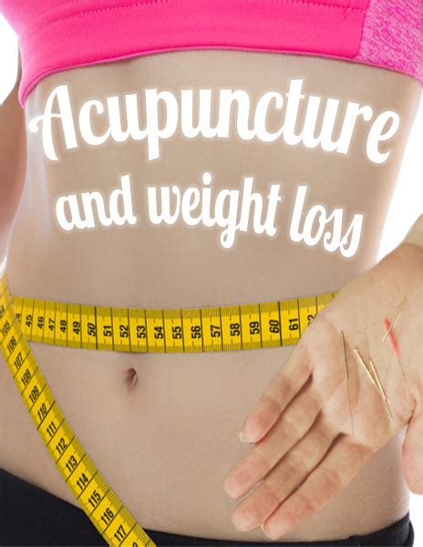 acupuncture-and-weight-loss — Ancient Practice Modern Healthcare. Alternative, Holistic ...