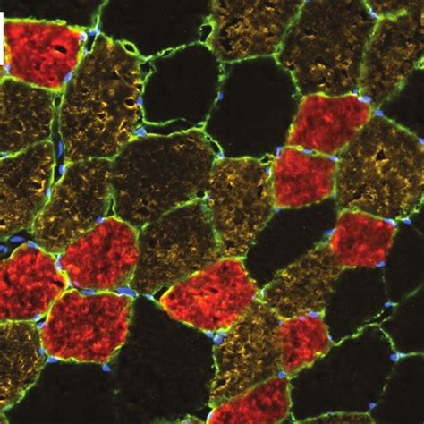 Muscle Fiber Cross Sections Stained By Myosin Heavy Chain Mhc Isoform