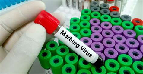 Enfermedad Del Virus De Marburgo Mvd Transmisión Síntomas Y Tratamiento