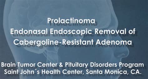 Pituitary Adenoma Videos | Pacific Pituitary Disorders Center