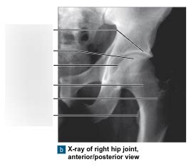 Hip Joint Diagram Quizlet