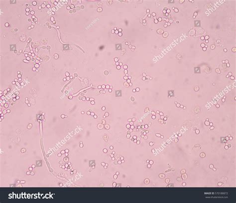 Budding Yeast Cell Structure Fine Microscope Shutterstock