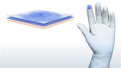 Biogel PI Indicator Underglove blue synthetic surgical glove Mölnlycke