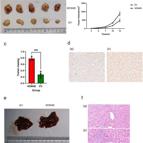 KDM4B Promotes Tumour Growth And Metastasis In Vivo A Tumors Grown