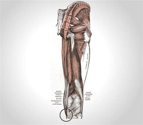 Tendinite Ou Tendinopathie De La Patte Doie Physioactif