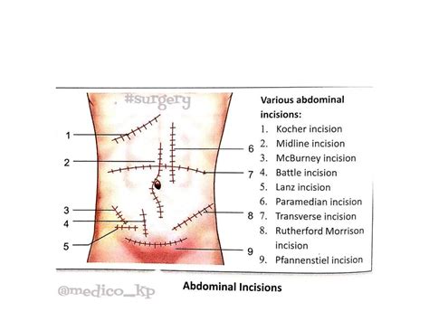 Types Of Incisions Presentation Lecture Ppt