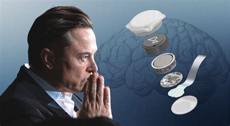 Elon Musk Successfully Implants Wireless Brain Chip In Human For First Time How It Works