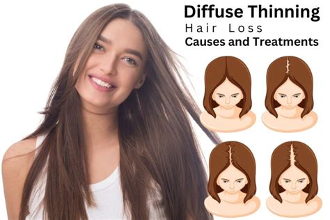 Diffuse Thinning Hair Loss Symptoms Causes And Treatments