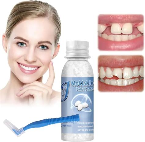 Kit De Dent Provisoire R Paration Dentier Sourire Parfait Dentier