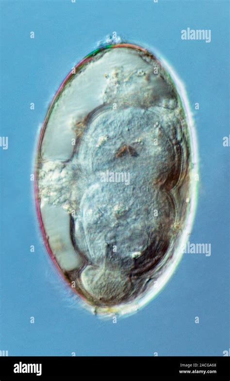 liver fluke egg macro photograph   liver fluke fasciola hepatica