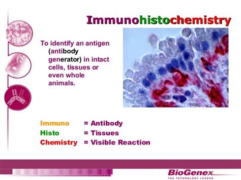 Immunohistochemistry analyses 