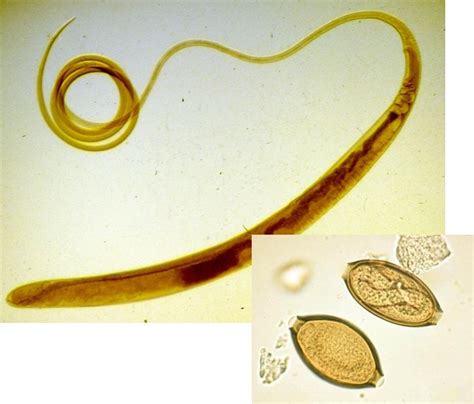 Trichuris Suis Swine Diagram Quizlet