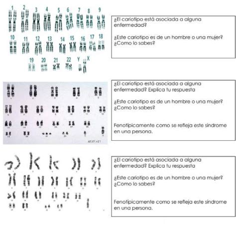 Observa Los Siguientes Cariotipos Y Con Base En Ellos Resuelve Las