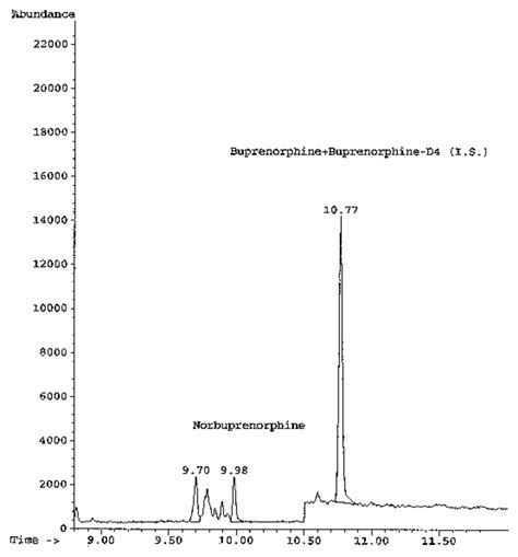 Representative Gas Chromatogram Of Buprenorphine Ng Ml And