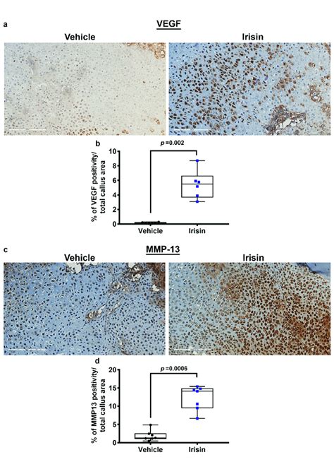 Representative Images Of A VEGF And C MMP 13 Immunostaining On