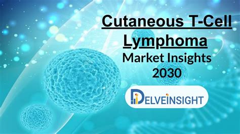 Cutaneous T Cell Lymphoma Ctcl Market Insights Epidemiology 2030 The Articles Directory