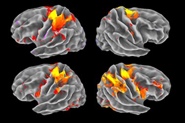 Functional-MRI | Mittal Diagnostic & Research Center Mittal Diagnostic ...