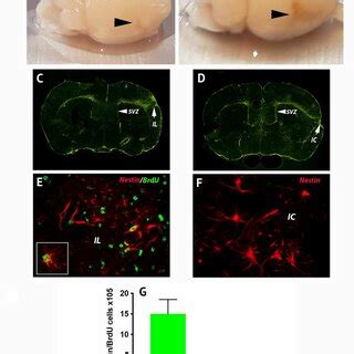 Lacuna Knockdown Promotes Differentiation Of Mouse Neural Stem Cells