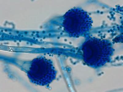 Aspergillus fumigatus | Microbiology, Medical laboratory scientist ...