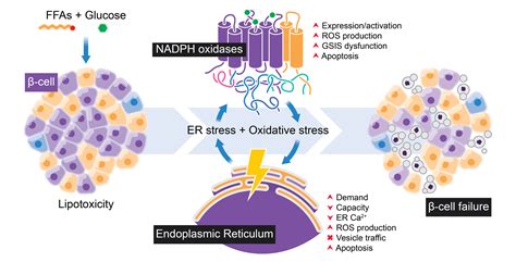 Cells Free Full Text Lipotoxicity and β Cell Failure in Type 2