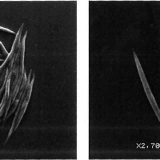 Pure culture of Ankistrodesmus falcatus viewed under a scanning ...