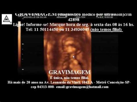 Gravimagem Ultrassom Morfol Gico D Em Gravidez Semanas