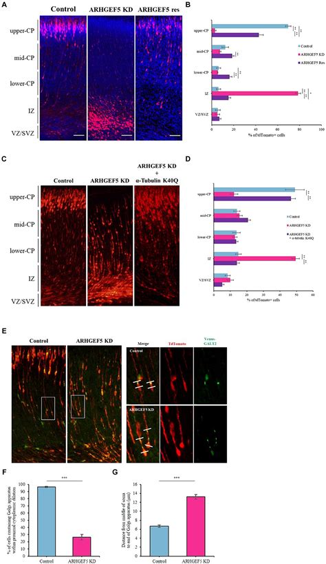 Frontiers Arhgef Binds Drebrin And Affects Tubulin Acetylation To