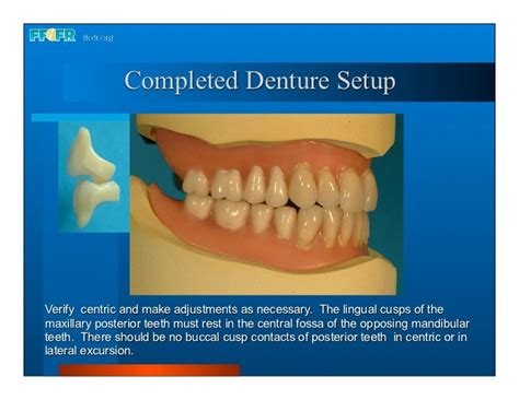 Complete Dentures 16occlusal Schemes Lingualized Occlusion