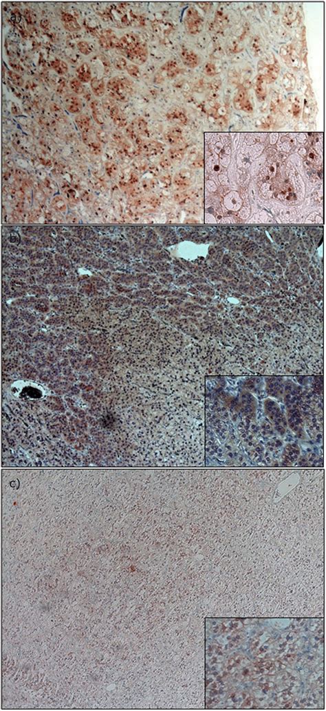 Immunohistochemical Expression Analysis Of β Catenin A Apa With Download Scientific Diagram