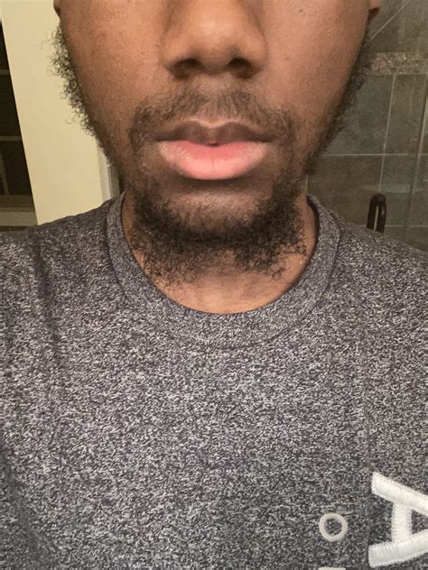 Is This A Good 18 Year Old Beard R Beards