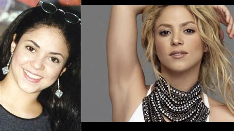 Shakira Antes Y Despues Las Cirugias