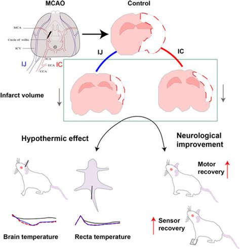 New Endovascular Approach for Hypothermia With Intrajugular Cooling and Neuroprotective Effect ...