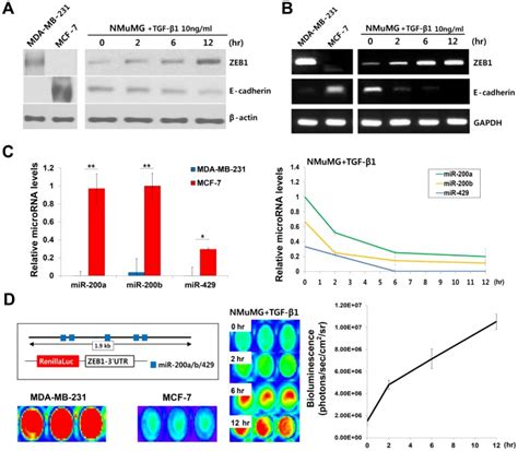 A B Western Blot And RT PCR Analyses Of ZEB1 And E Cadherin In