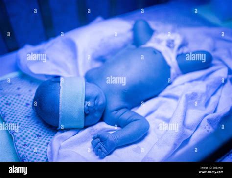 Newborn Having A Treatment For Jaundice Under Ultraviolet Light Baby