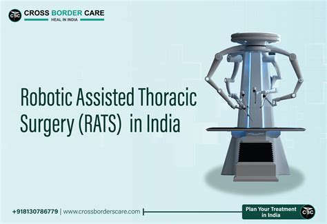 Robotic Assisted Thoracic Surgery (RATS) Program in India