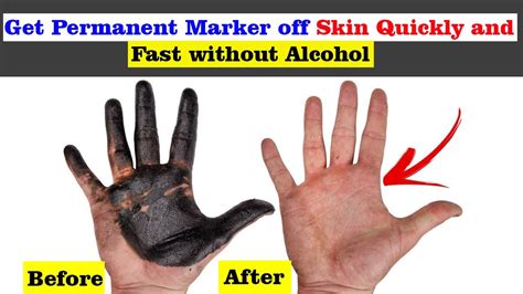 How To Remove Permanent Marker From Skin Quickly Fast Without Alcohol