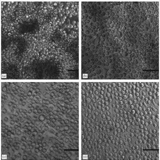 Phase Contrast Micrographs Of Cultured Cord Blood Cd Cells At Day