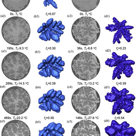 PDF Fast Synchrotron X Ray Tomographic Quantification Of Dendrite