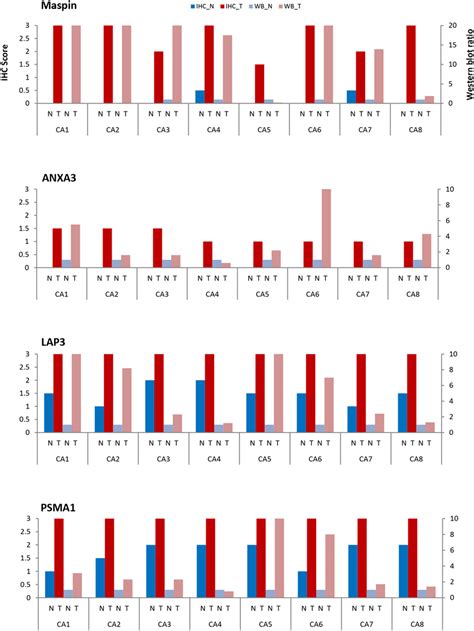 Comparison Of Maspin Anxa Lap And Psma Expressions By Ihc And