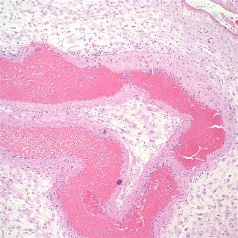 Chapter Placental Perfusion Section A Spiral Arteries Obstetrical