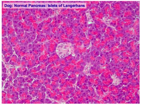 Endocrine Pathology 2 Specific Conditions Flashcards Quizlet