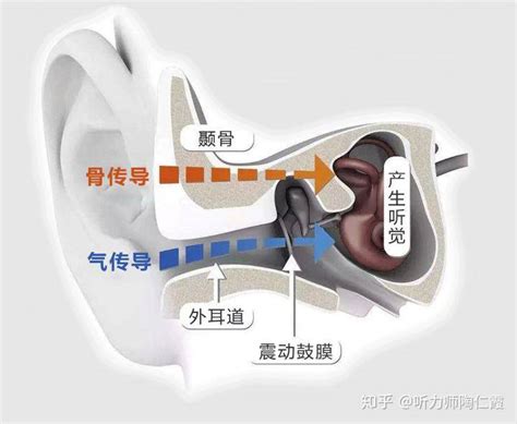 如何看懂“听力图”？声音