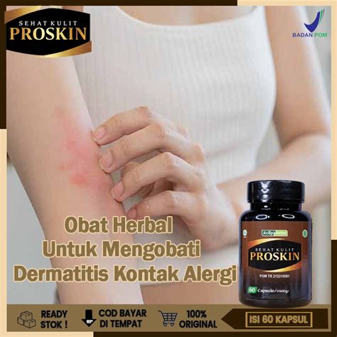 Jual Obat Dermatitis Kontak Alergi Kulit Ruam Merah Melepuh Bintik