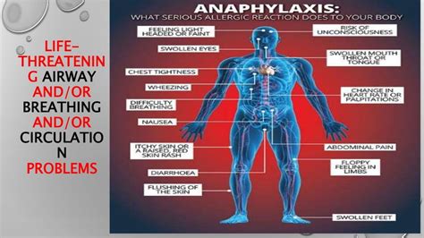 Anaphylactic shock