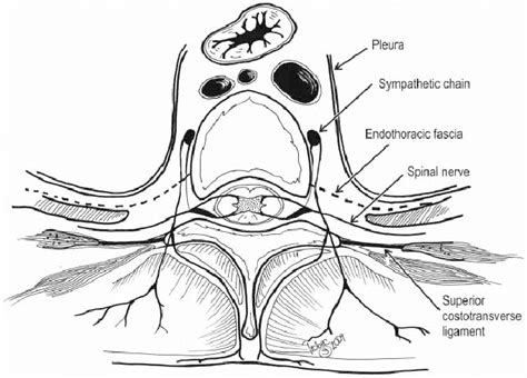 Anatomy Of The Thoracic Paravertebral Space Download Scientific Diagram