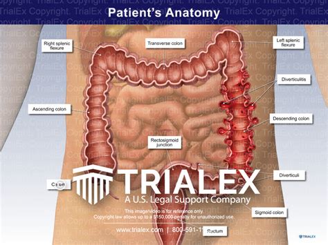 Patients Anatomy Trialquest Inc