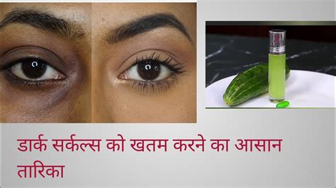 Easy Remedy To Get Rid Of Dark Circlesकाले घेरे कम करने के उपाय 🤫 Youtubevideo Homeremedies