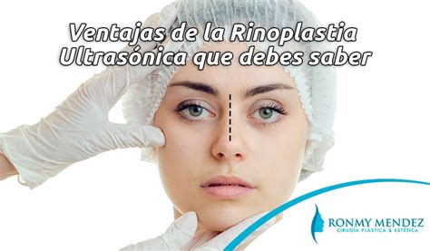 12 tipos de nariz que se pueden corregir con Rinoplastia Así se ve la